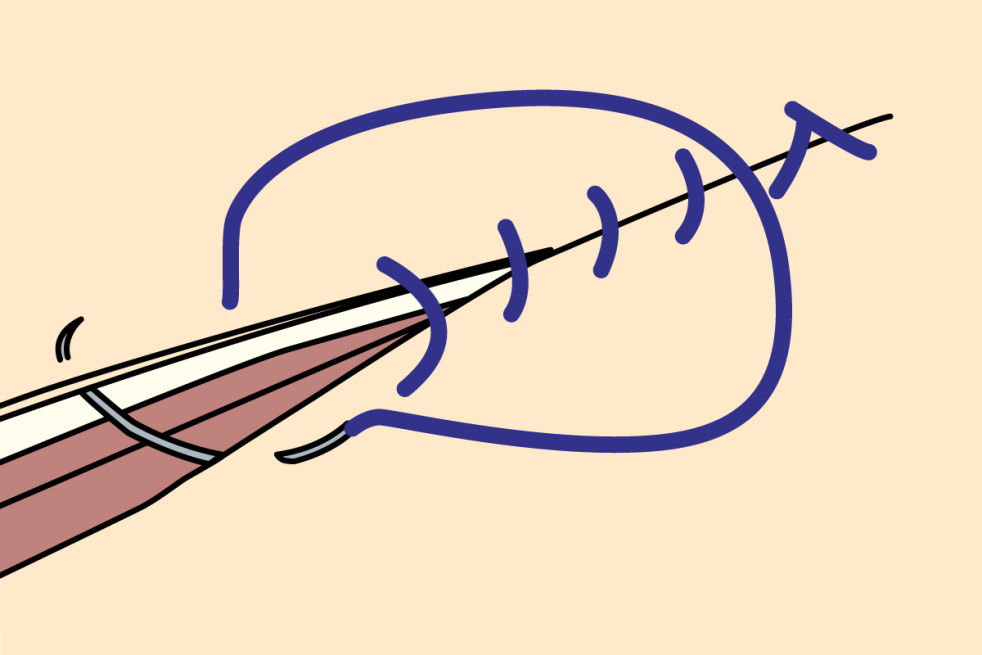 Clinical Suturing Continuous